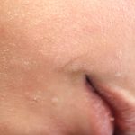 Do Body Scrubs Help Dry or Dull Skin?