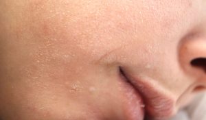 Do Body Scrubs Help Dry or Dull Skin?