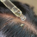 How Scalp Treatments Improve Facial Hydration?