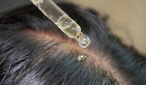 How Scalp Treatments Improve Facial Hydration?